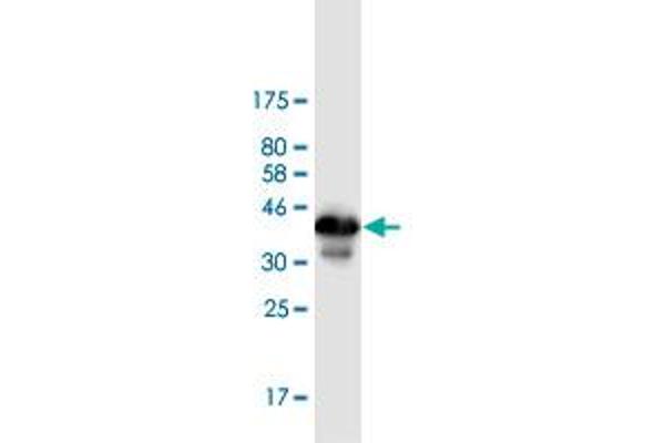 ZBTB6 Antikörper  (AA 121-220)