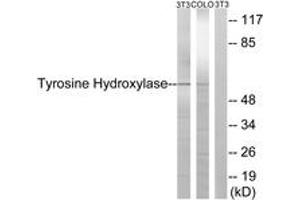 Western blot analysis of extracts from NIH-3T3/COLO cells, treated with Forskolin 40nM 30', using Tyrosine Hydroxylase (Ab-19) Antibody. (Tyrosine Hydroxylase anticorps  (AA 10-59))