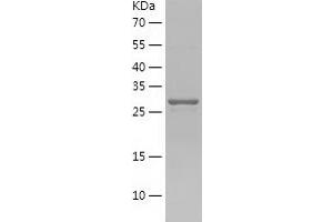 Western Blotting (WB) image for Heparan Sulfate (Glucosamine) 3-O-Sulfotransferase 1 (HS3ST1) (AA 21-307) protein (His tag) (ABIN7123299)