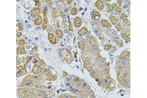 Immunohistochemistry of paraffin-embedded Human stomach using TRPA1 Polyclonal Antibody at dilution of 1:100 (40x lens). (TRPA1 anticorps)