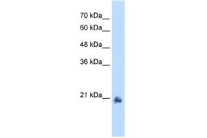 WB Suggested Anti-METTL7A Antibody Titration:  2. (METTL7A anticorps  (N-Term))