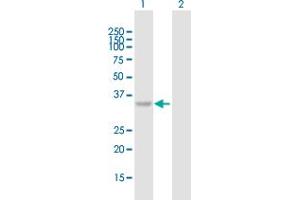 Western Blot analysis of C10orf46 expression in transfected 293T cell line by C10orf46 MaxPab polyclonal antibody. (CACUL1 anticorps  (AA 1-303))