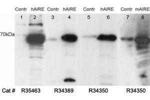 Western blot testing of untransfected (lane 1) and transfected (lane 2) HEK293 cell lysates with AIRE antibody at 0. (AIRE anticorps)
