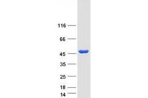 Validation with Western Blot