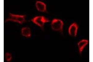 ABIN6276565 staining HepG2 by IF/ICC.