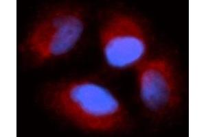 Immunofluorescence (IF) image for anti-Cyclin I (CCNI) (AA 1-377) antibody (PE) (ABIN5565347)