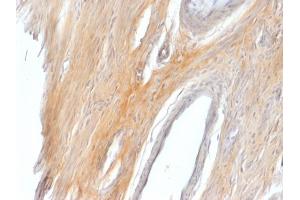 Formalin-fixed, paraffin-embedded Rat Uterus stained with Caldesmon Rabbit Polyclonal Antibody.