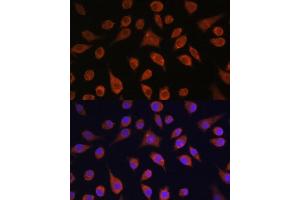 Immunofluorescence analysis of L929 cells using HOOK3 antibody (ABIN7267781) at dilution of 1:100. (HOOK3 anticorps  (AA 489-718))