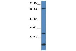 GSTM5 antibody used at 1 ug/ml to detect target protein. (GSTM5 anticorps  (N-Term))