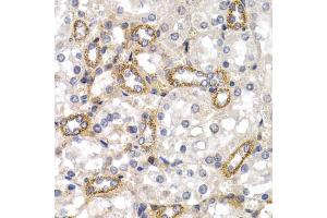 Immunohistochemistry of paraffin-embedded rat kidney using CD83 antibody (ABIN5971072) at dilution of 1/200 (40x lens). (CD83 anticorps)