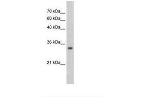 Image no. 1 for anti-Zinc Finger Protein 227 (ZNF227) (AA 301-350) antibody (ABIN203042) (ZNF227 anticorps  (AA 301-350))