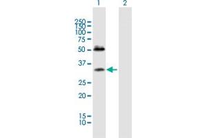 Western Blot analysis of SDC4 expression in transfected 293T cell line by SDC4 MaxPab polyclonal antibody. (SDC4 anticorps  (AA 1-198))