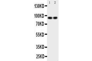 Anti-MALT1 antibody, Western blotting Lane 1: MCF-7 Cell Lysate Lane 2: HELA Cell Lysate (MALT1 anticorps  (C-Term))