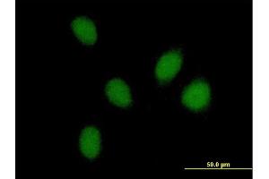 Immunofluorescence of purified MaxPab antibody to PHF16 on HeLa cell. (PHF16 anticorps  (AA 1-823))