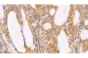 Detection of MCL1 in Human Thyroid Tissue using Polyclonal Antibody to Induced Myeloid Leukemia Cell Differentiation Protein Mcl-1 (MCL1)