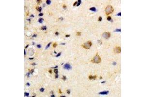 Immunohistochemical analysis of NEK7 staining in human brain formalin fixed paraffin embedded tissue section. (NEK7 anticorps)