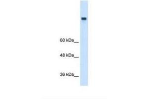 Image no. 1 for anti-Microsomal Triglyceride Transfer Protein (MTTP) (N-Term) antibody (ABIN6738087) (MTTP anticorps  (N-Term))