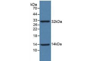 Detection of Recombinant ISR, Human using Polyclonal Antibody to Insulin Receptor (INSR)