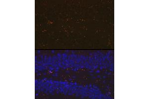 Immunofluorescence analysis of mouse brain using //IB Rabbit mAb (9776) at dilution of 1:100 (40x lens). (Iba1 anticorps)