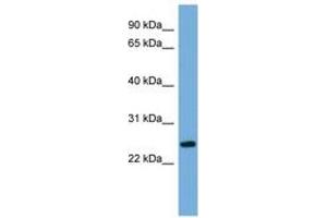 Image no. 1 for anti-Protein FAM164B (ZC2HC1B) (AA 35-84) antibody (ABIN6745661) (FAM164B anticorps  (AA 35-84))