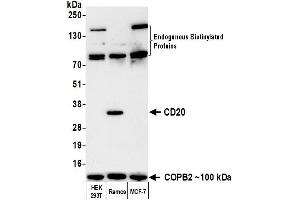 Western Blotting (WB) image for anti-Biotin antibody (ABIN7795729) (Recombinant Biotin anticorps)