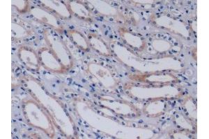 Detection of COL4a3 in Human Kidney Tissue using Polyclonal Antibody to Collagen Type IV Alpha 3 (COL4a3)