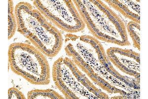 ABIN7093988 and ABIN7098032 at 1/100 staining mouse colorectal tissue by IHC-P. (Sphingomyelin Synthase 1 anticorps  (N-Term))
