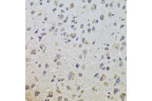 Immunohistochemistry of paraffin-embedded mouse brain using EGFR antibody (ABIN5997646) at dilution of 1/100 (40x lens). (EGFR anticorps)