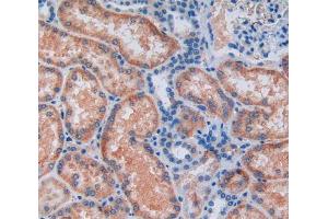 IHC-P analysis of kidney tissue, with DAB staining. (ALDH7A1 anticorps  (AA 1-539))