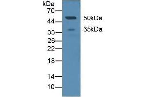 Detection of CD299 in Human Serum using Polyclonal Antibody to Cluster Of differentiation 299 (CD299)