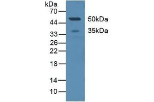 Detection of CD299 in Human Serum using Polyclonal Antibody to Cluster Of differentiation 299 (CD299) (C-Type Lectin Domain Family 4, Member M (CLEC4M) (AA 242-399) anticorps)