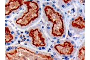 IFT88 polyclonal antibody  (3 ug/mL) staining of paraffin embedded human kidney. (IFT88 anticorps  (C-Term))