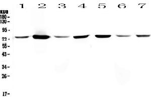 Western blot analysis of Annexin VI using anti-Annexin VI antibody .
