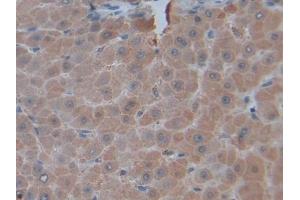 Detection of TNFSF14 in Human Liver Tissue using Polyclonal Antibody to Tumor Necrosis Factor Ligand Superfamily, Member 14 (TNFSF14)