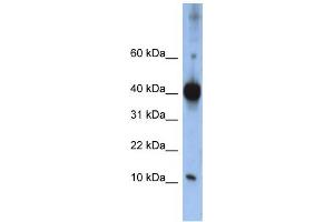 Western Blotting (WB) image for anti-LSM4 Homolog, U6 Small Nuclear RNA Associated (LSM4) antibody (ABIN2458525) (LSM4 anticorps)