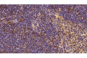 Detection of MMP9 in Mouse Spleen Tissue using Polyclonal Antibody to Matrix Metalloproteinase 9 (MMP9)