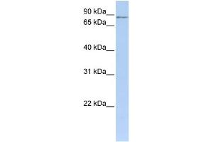 WB Suggested Anti-MTO1 Antibody Titration: 0. (MTO1 anticorps  (N-Term))