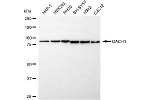 anti-Dachshund 1 (DACH1) antibody