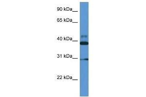 Western Blot showing VASP antibody used at a concentration of 1 ug/ml against Fetal Heart Lysate