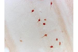Formalin-fixed and paraffin embedded chicken testis tissue labeled with Anti-Neurturin Polyclonal Antibody, Unconjugated (ABIN724505) 1:200 followed by conjugation to the secondary antibody and DAB staining (Neurturin anticorps  (AA 151-197))