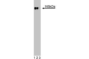 Western blot analysis of Desmoglein on a HeLa cell lysate (Human cervical epitheloid carcinoma, ATCC CCL-2.