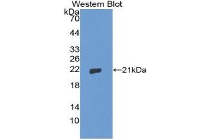 Western blot analysis of the recombinant protein. (Thimet Oligopeptidase 1 anticorps  (AA 451-597))
