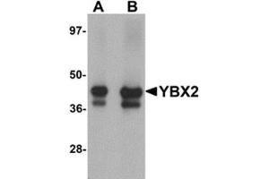 Western blot analysis of YBX2 in human testis tissue lysate with YBX2 antibody at (A) 1 and (B) 2 μg/ml. (YBX2 anticorps  (C-Term))