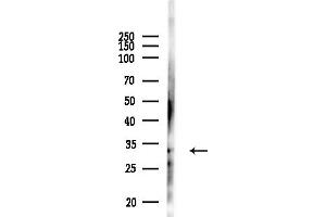 anti-Hydroxysteroid (11-Beta) Dehydrogenase 1 (HSD11B1) (N-Term) antibody