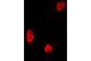 Immunofluorescent analysis of Sox-5 staining in U2OS cells.