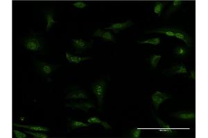 Immunofluorescence of monoclonal antibody to PDE5A on HeLa cell. (PDE5A anticorps  (AA 29-138))