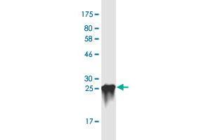 Western Blot detection against Immunogen (31.