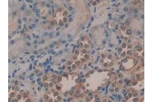 Detection of PGA in Human Kidney Tissue using Polyclonal Antibody to Pepsinogen A (PGA)