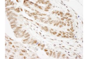 Immunohistochemistry (IHC) image for anti-Wilms Tumor 1 Associated Protein (WTAP) (AA 346-396) antibody (ABIN7449036) (WTAP anticorps  (AA 346-396))