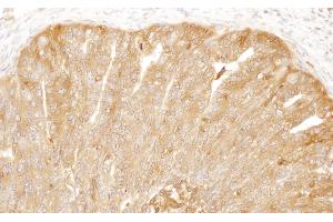 Immunohistochemistry (IHC) image for anti-CAP, Adenylate Cyclase-Associated Protein 1 (CAP1) (AA 275-325) antibody (ABIN7455049) (CAP1 anticorps  (AA 275-325))